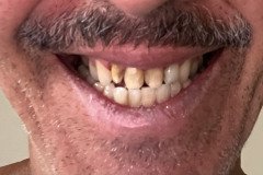 IMG_0710-2